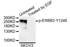Western blot analysis of extracts of SKOV3 cell line, using Phospho-ERBB2-Y1248 antibody (ABIN5995620). (ErbB2/Her2 anticorps  (pTyr1248))