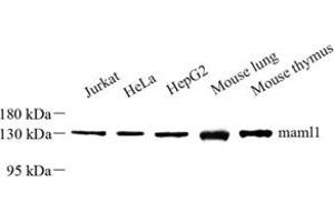 Western blot analysis of maml1 (ABIN7074560) at dilution of 1: 500 (MAML1 anticorps)