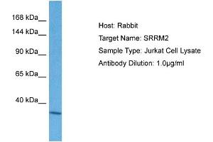 Host: Rabbit Target Name: SRRM2 Sample Tissue: Human Jurkat Whole Cell Antibody Dilution: 1ug/ml (SRRM2 anticorps  (C-Term))