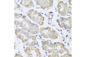 Immunohistochemistry of paraffin-embedded human stomach using L2HGDH antibody (ABIN5975242) at dilution of 1/100 (40x lens). (L2HGDH anticorps)