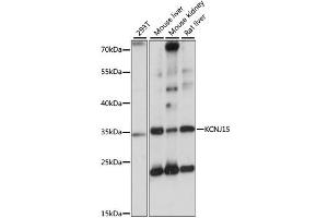 Western blot analysis of extracts of various cell lines, using KCNJ15 antibody. (KCNJ15 anticorps)