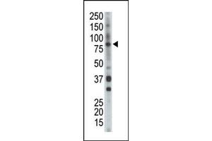 Image no. 1 for anti-BMX Non-Receptor Tyrosine Kinase (BMX) (Middle Region) antibody (ABIN359973) (BMX anticorps  (Middle Region))
