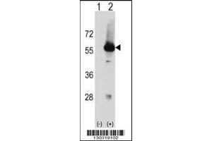 Western blot analysis of Stk3 using rabbit polyclonal Mouse Stk3 Antibody using 293 cell lysates (2 ug/lane) either nontransfected (Lane 1) or transiently transfected (Lane 2) with the Stk3 gene. (STK3 anticorps  (C-Term))