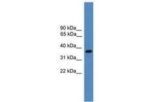 anti-Bartter Syndrome, Infantile, with Sensorineural Deafness (Barttin) (BSND) (AA 211-260) antibody