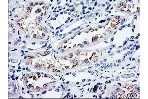 Immunohistochemistry (IHC) image for anti-Cyclin-Dependent Kinase Inhibitor 3 (CDKN3) antibody (ABIN1497459) (CDKN3 anticorps)