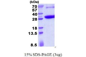Image no. 1 for Potassium Channel Tetramerisation Domain Containing 5 (KCTD5) protein (His tag) (ABIN1098451) (KCTD5 Protein (His tag))