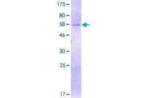 Image no. 1 for Sirtuin 4 (SIRT4) (AA 1-314) protein (GST tag) (ABIN1320048)