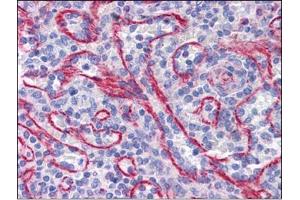 Human Spleen: Formalin-Fixed, Paraffin-Embedded (FFPE) (STAU1/Staufen anticorps  (C-Term))