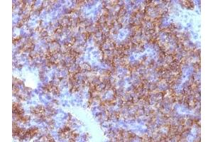 Formalin-fixed, paraffin-embedded human parathyroid stained with Chromogranin A antibody (CHGA/798)