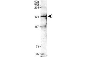 Western blot analysis of Trpm2 in mouse brain membrane lysates with Trpm2 polyclonal antibody . (TRPM2 anticorps  (AA 1200-1300))