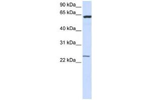 Western Blotting (WB) image for anti-Transmembrane Protein 138 (TMEM138) antibody (ABIN2459085) (TMEM138 anticorps)