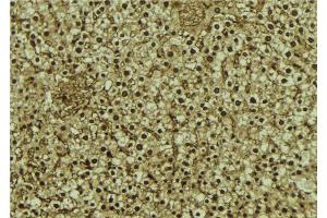 ABIN6273069 at 1/100 staining Mouse liver tissue by IHC-P. (RBM4 anticorps  (Internal Region))