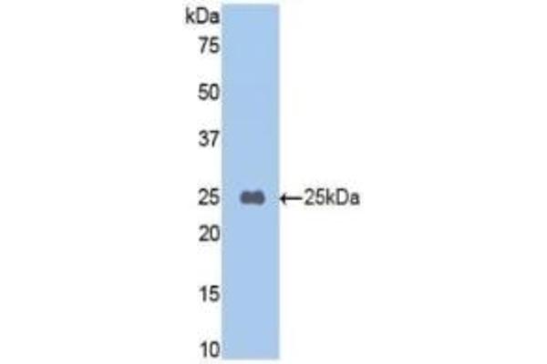 CPB2 Antikörper  (AA 187-327)