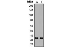 Western blot analysis of Carbonic Anhydrase 8 expression in MCF7 (A), NS-1 (B) whole cell lysates.