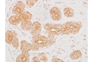 Immunohistochemistry (IHC) image for anti-Mitogen-Activated Protein Kinase Kinase 2 (MAP2K2) (AA 1-50) antibody (ABIN7454013)