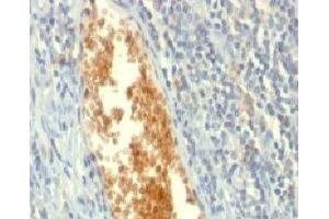Formalin-fixed, paraffin-embedded human tonsil stained with AMPD3 antibody (AMPD3/901)