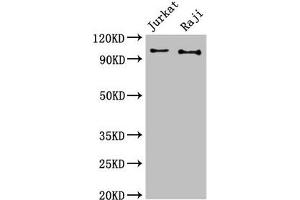 Western Blot Positive WB detected in: Jurkat whole cell lysate, Raji whole cell lysate All lanes: CBL antibody at 3 μg/mL Secondary Goat polyclonal to rabbit IgG at 1/50000 dilution Predicted band size: 100 kDa Observed band size: 100 kDa (CBL anticorps  (AA 548-847))