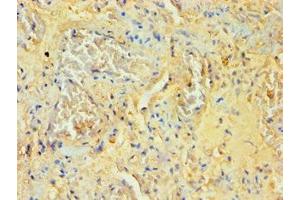 Immunohistochemistry of paraffin-embedded human lung tissue using ABIN7170995 at dilution of 1:100