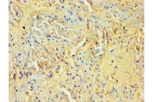 Immunohistochemistry of paraffin-embedded human lung tissue using ABIN7170995 at dilution of 1:100 (SOCS2 anticorps  (AA 1-198))