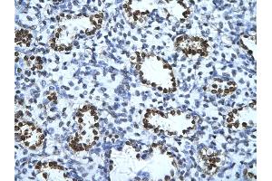 Rabbit Anti-ENO1 Antibody       Paraffin Embedded Tissue:  Human alveolar cell   Cellular Data:  Epithelial cells of renal tubule  Antibody Concentration:   4.
