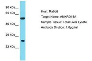 Image no. 1 for anti-Ankyrin Repeat Domain 18A (ANKRD18A) (AA 781-830) antibody (ABIN6750781) (ANKRD18A anticorps  (AA 781-830))