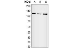 Western blot analysis of UBE4A expression in HepG2 (A), SP2/0 (B), H9C2 (C) whole cell lysates. (UBE4A anticorps  (N-Term))