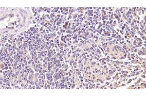 Detection of KLRK1 in Human Spleen Tissue using Monoclonal Antibody to Killer Cell Lectin Like Receptor Subfamily K, Member 1 (KLRK1)