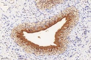 Immunohistochemistry analysis of paraffin-embedded rat bladder using,Uroplakin Ia (ABIN7076160) at dilution of 1: 4000