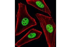 Fluorescent image of Hela cells stained with SP1 Antibody (ABIN1944791 and ABIN2838536).