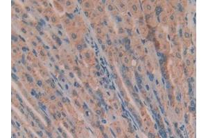 Used in DAB staining on fromalin fixed paraffin- embedded brain tissue (ANG anticorps  (AA 25-145))