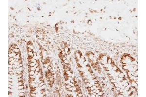 IHC-P Image PNPase antibody detects PNPase protein at mitochondria on human normal colon by immunohistochemical analysis. (PNPT1 anticorps)