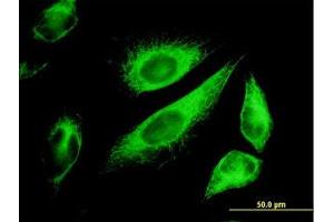 Image no. 5 for anti-Keratin 18 (KRT18) (AA 1-431) antibody (ABIN598778) (Cytokeratin 18 anticorps  (AA 1-431))