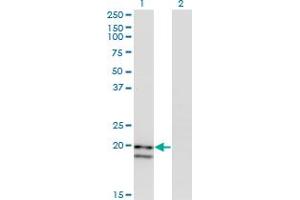 Western Blot analysis of IFNA2 expression in transfected 293T cell line by IFNA2 monoclonal antibody. (IFNA2 anticorps  (AA 24-188))
