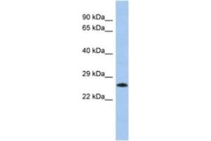 Western Blotting (WB) image for anti-MGC50273 antibody (ABIN2463949) (MGC50273 anticorps)