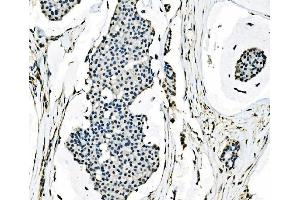 IHC analysis of splicing factor 1 using anti-splicing factor 1 antibody (ABIN7600194). (Splicing Factor 1 anticorps  (AA 160-266))