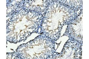 IHC analysis of MCM6 using anti-MCM6 antibody (ABIN7600038).