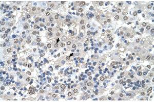 Human Liver (CDR2 anticorps  (N-Term))