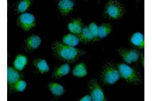 IF analysis of PDP1/PDP using anti-PDP1/PDP antibody (ABIN7601509). (PDP anticorps  (AA 37-537))