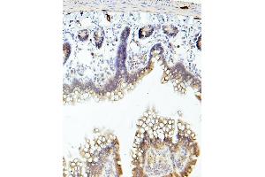 IHC analysis of TEK using anti-TEK antibody (ABIN7600762). (TEK anticorps  (AA 23-616))