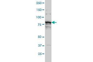 THNSL1 monoclonal antibody (M08), clone 6B1 Western Blot analysis of THNSL1 expression in Hela S3 NE . (THNSL1 anticorps  (AA 151-250))