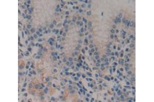 Figure. (Gastrokine 2 anticorps  (AA 21-184))