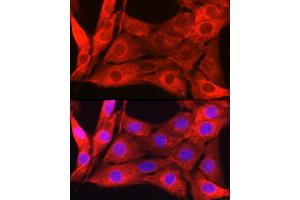 Immunofluorescence analysis of NIH/3T3 cells using Galectin 1/LG Rabbit pAb (ABIN6130424, ABIN6143156, ABIN6143157 and ABIN6218649) at dilution of 1:50 (40x lens).