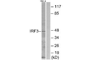 Immunohistochemistry analysis of paraffin-embedded human brain tissue using IRF3 (Ab-396) antibody. (IRF3 anticorps  (Ser396))