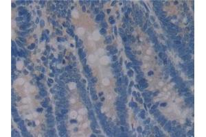 Detection of OPN in Rat Intestine Tissue using Polyclonal Antibody to Osteopontin (OPN)