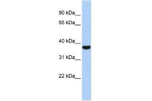 WB Suggested Anti-EXOSC2 Antibody Titration:  0.