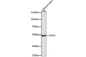 Western blot analysis of extracts of Mouse heart using SPAST Polyclonal Antibody at dilution of 1:3000. (Spastin anticorps)