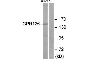 Western blot analysis of extracts from HUVEC cells, using GPR126 antibody. (G Protein-Coupled Receptor 126 anticorps)