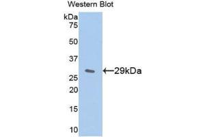Western Blotting (WB) image for anti-Inhibitory Subunit of NF-KappaB epsilon (AA 207-440) antibody (ABIN3203929) (Inhibitory Subunit of NF-KappaB epsilon (AA 207-440) anticorps)