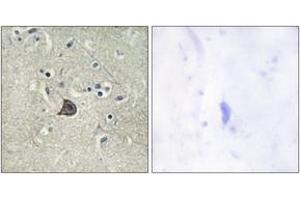 Immunohistochemistry analysis of paraffin-embedded human brain, using PLC beta3 (Phospho-Ser537) Antibody. (PLCB3 anticorps  (pSer537))