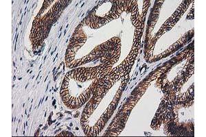 Image no. 2 for anti-Catenin (Cadherin-Associated Protein), beta 1, 88kDa (CTNNB1) antibody (ABIN1496894)